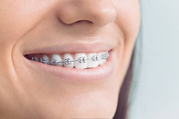 Best Invisalign and Clear Aligners  in Galva, IL